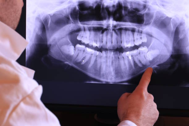 Best Urgent Dental Care for Toothaches in Hurt, VA